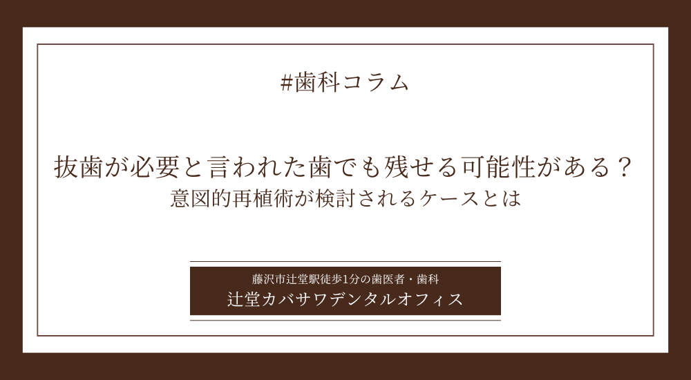 抜歯が必要と言われた歯でも残せる可能性がある?意図的再植術が検討されるケースとは